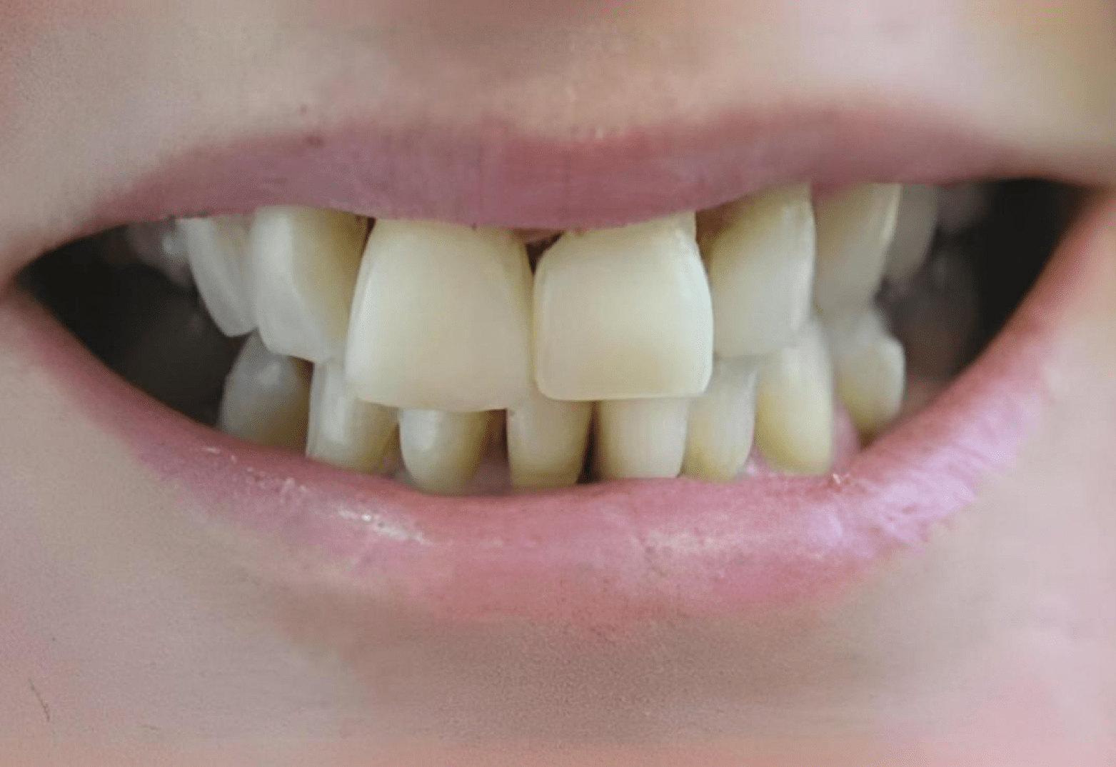 Frame 2147225414 Frame 2147225414