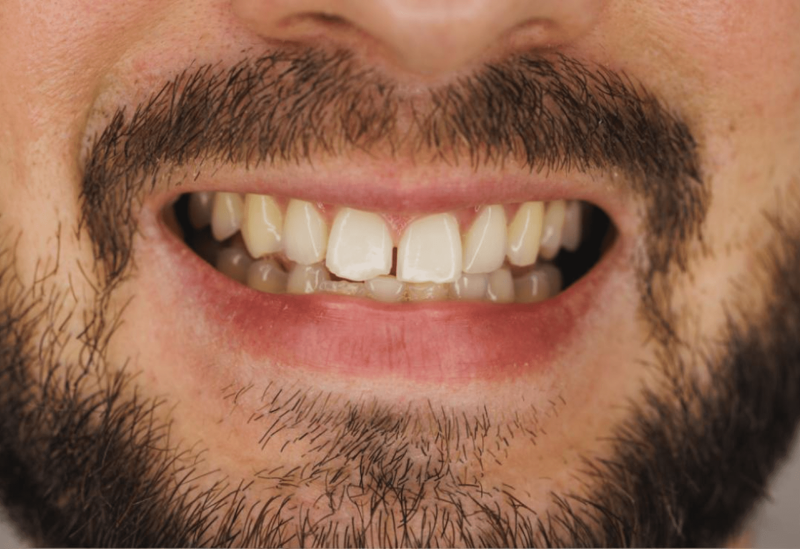 Frame 2147225422 Frame 2147225422