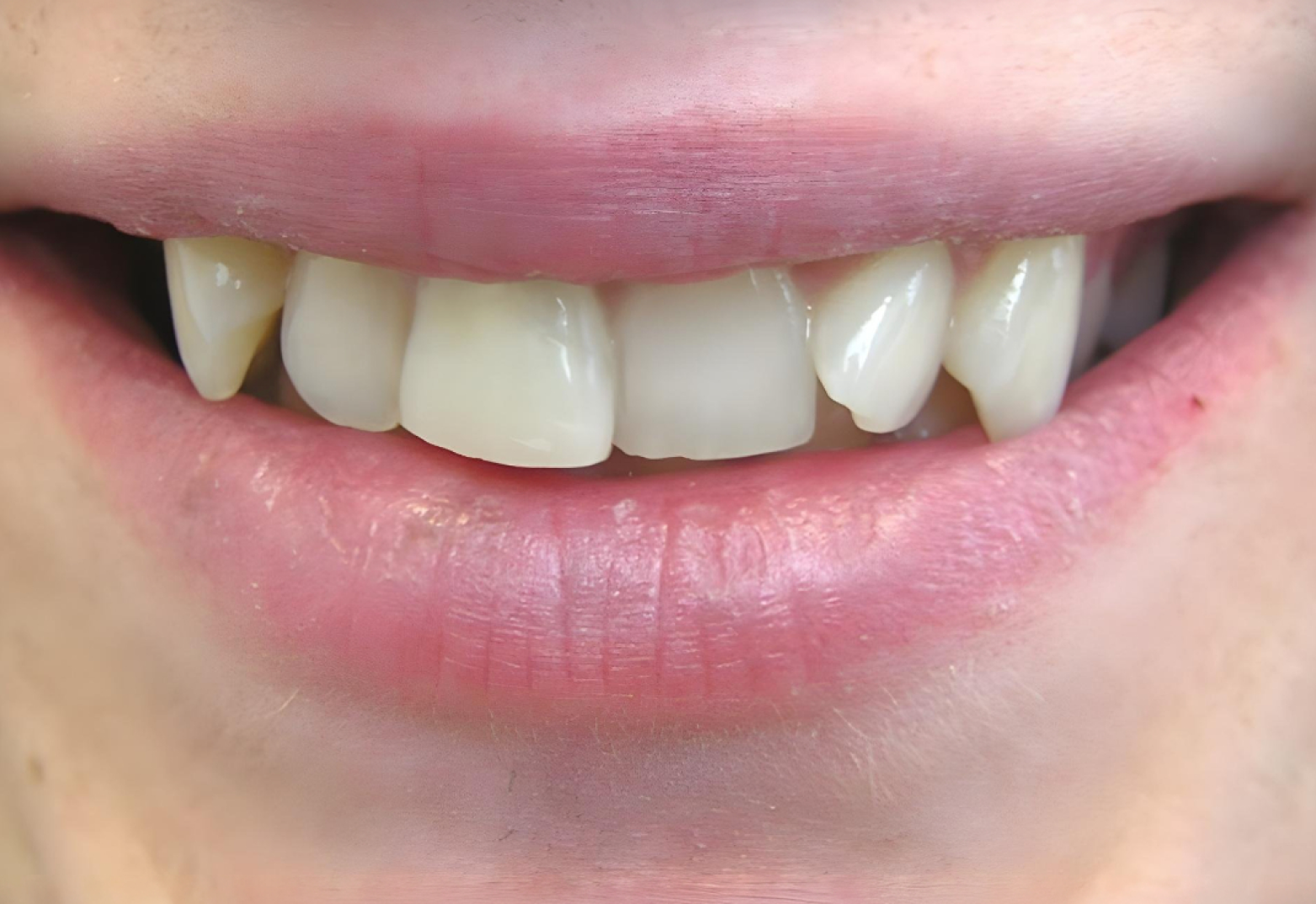 Frame 2147225416 Frame 2147225416