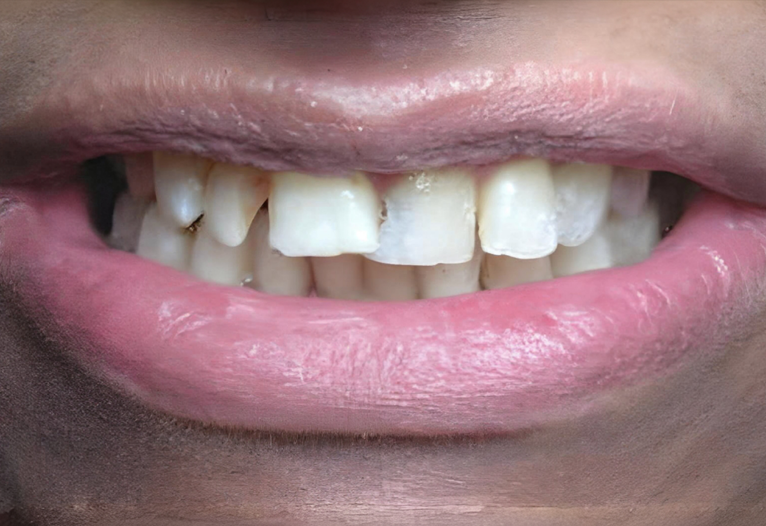 Frame 2147225418 Frame 2147225418