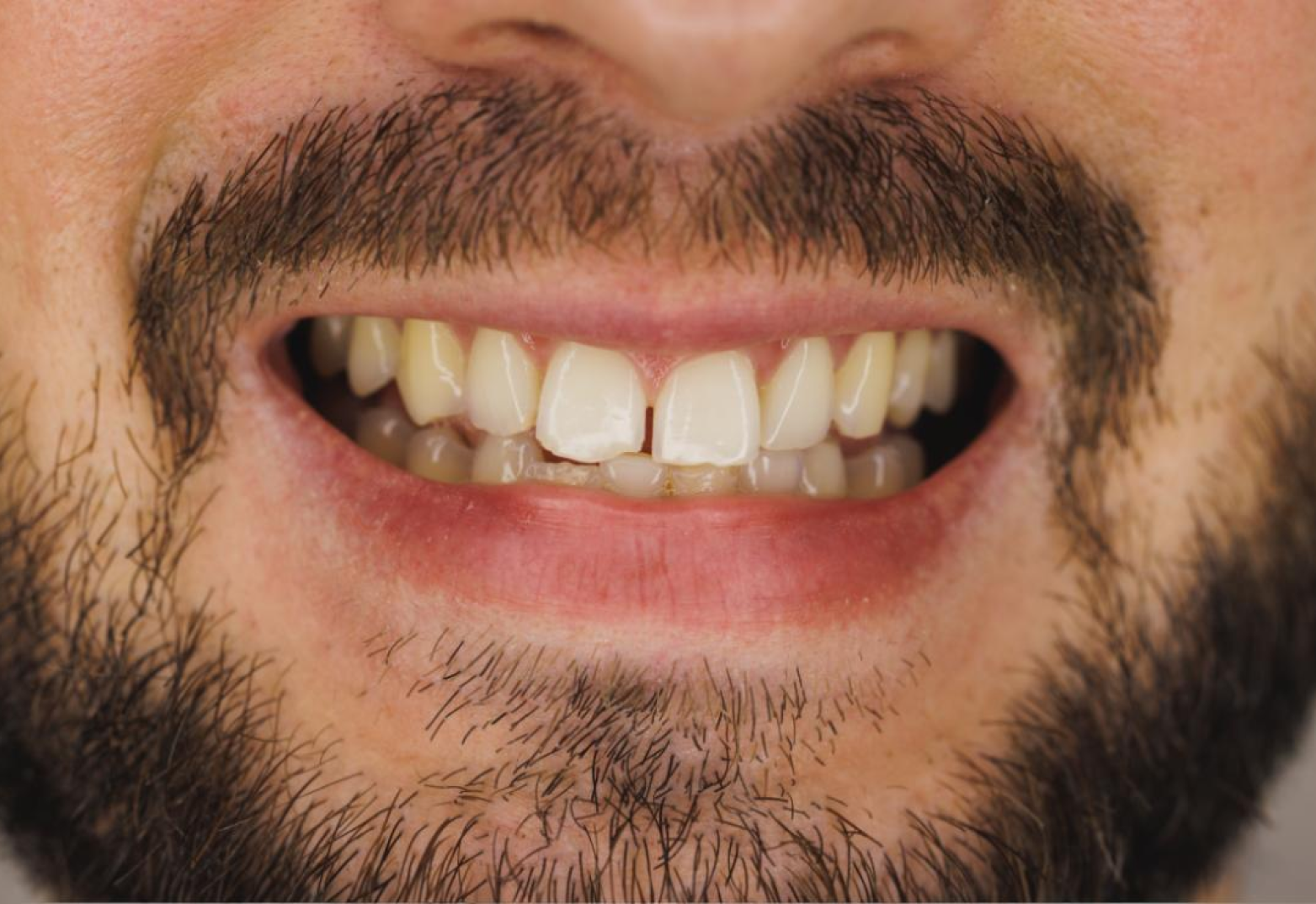 Frame 2147225422 Frame 2147225422