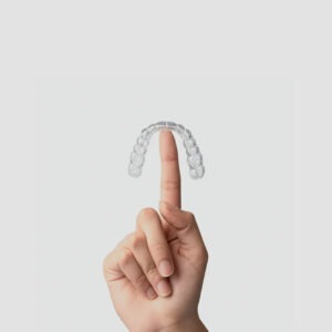 All day aligners